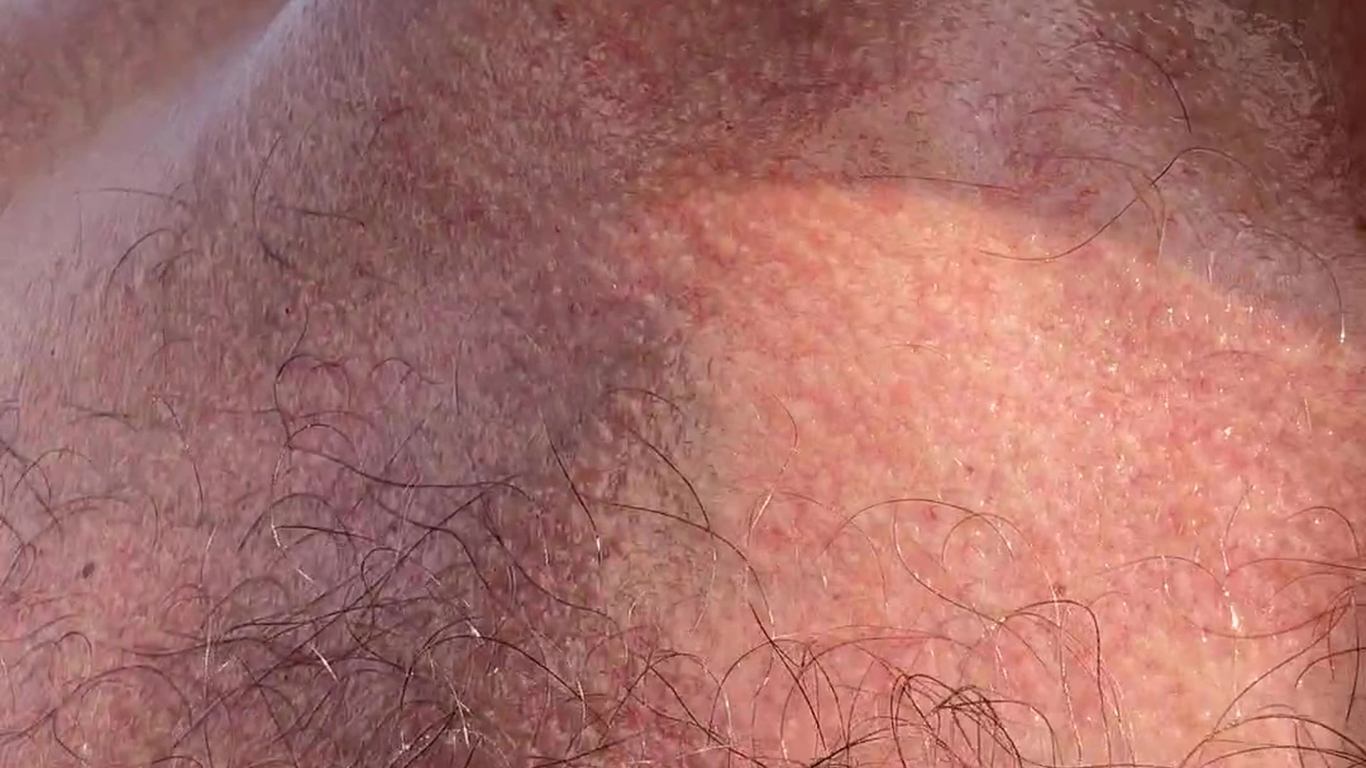 Effervescent  Chiseled jakubstefano nsfw Full Video Leaked Sensational
