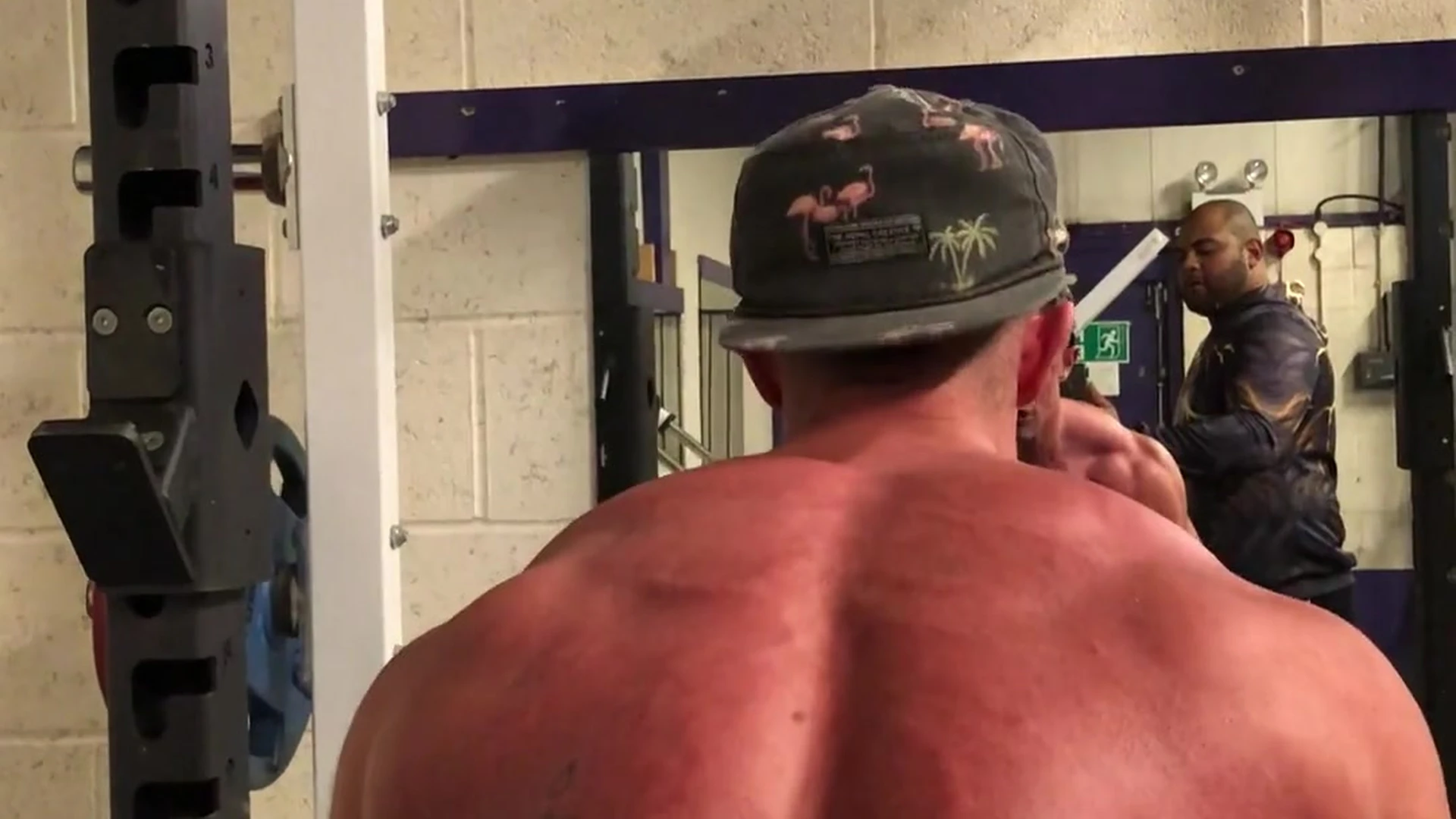 vascular throatedtv   Exposed